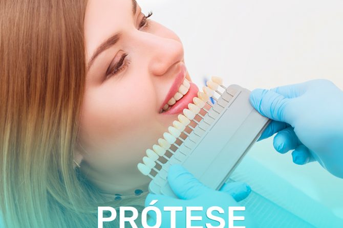 Próteses: proteção necessária para o implante durar mais ou substituição completa de dentes perdidos