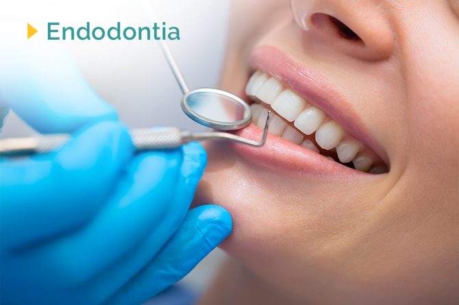 Endodontia: o conhecido popularmente tratamento de canal