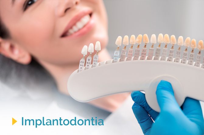 Implantes: recurso mais avançado na reposição de perdas dentárias.