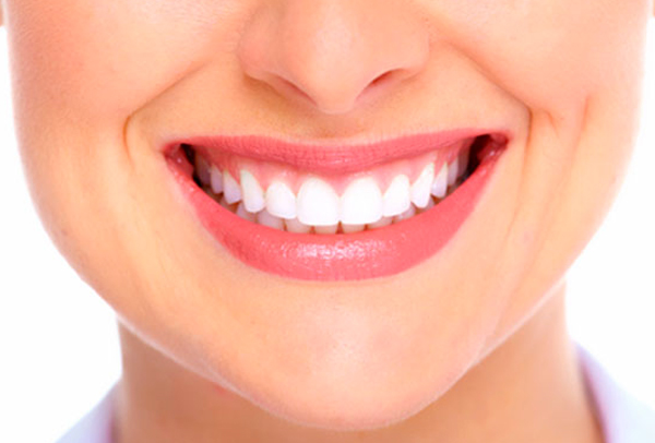 Clareamento e Facetas: tratamentos para um sorriso mais bonito