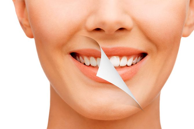 Clareamento Dental – seu sorriso iluminado