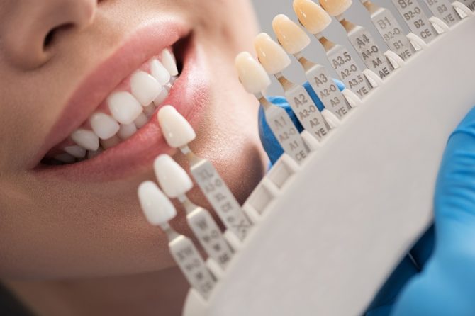 Prótese Dentária – para voltar a sorrir com segurança